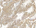 KLF2 Antibody in Immunohistochemistry (Paraffin) (IHC (P))