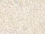 KLF2 Antibody in Immunohistochemistry (Paraffin) (IHC (P))