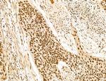 KLF2 Antibody in Immunohistochemistry (Paraffin) (IHC (P))