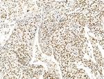 KLF2 Antibody in Immunohistochemistry (Paraffin) (IHC (P))