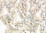 NKG2A Antibody in Immunohistochemistry (Paraffin) (IHC (P))