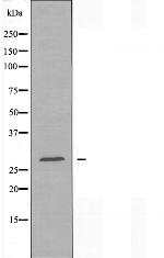 NKG2A Antibody in Western Blot (WB)