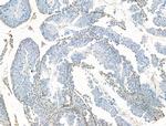 SETDB1 Antibody in Immunohistochemistry (Paraffin) (IHC (P))