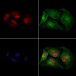 SUV420H2 Antibody in Immunocytochemistry (ICC/IF)