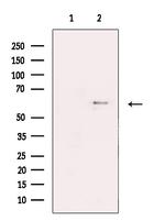 KV1.6 (KCNA6) Antibody in Western Blot (WB)