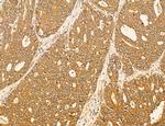 LARS2 Antibody in Immunohistochemistry (Paraffin) (IHC (P))