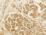 LARS2 Antibody in Immunohistochemistry (Paraffin) (IHC (P))