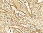 LARS2 Antibody in Immunohistochemistry (Paraffin) (IHC (P))