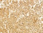 LARS2 Antibody in Immunohistochemistry (Paraffin) (IHC (P))