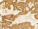 LARS2 Antibody in Immunohistochemistry (Paraffin) (IHC (P))