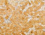 LARS2 Antibody in Immunohistochemistry (Paraffin) (IHC (P))