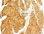 LARS2 Antibody in Immunohistochemistry (Paraffin) (IHC (P))