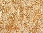 LARS2 Antibody in Immunohistochemistry (Paraffin) (IHC (P))