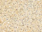 LARS2 Antibody in Immunohistochemistry (Paraffin) (IHC (P))