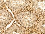 LARS2 Antibody in Immunohistochemistry (Paraffin) (IHC (P))