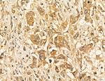 LARS2 Antibody in Immunohistochemistry (Paraffin) (IHC (P))