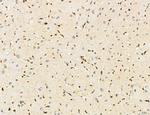 Lass2 Antibody in Immunohistochemistry (Paraffin) (IHC (P))