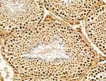 Lass2 Antibody in Immunohistochemistry (Paraffin) (IHC (P))