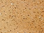 Lass2 Antibody in Immunohistochemistry (Paraffin) (IHC (P))