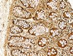 Lass2 Antibody in Immunohistochemistry (Paraffin) (IHC (P))