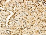 Lass2 Antibody in Immunohistochemistry (Paraffin) (IHC (P))