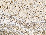 Lass2 Antibody in Immunohistochemistry (Paraffin) (IHC (P))