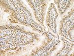 Lass2 Antibody in Immunohistochemistry (Paraffin) (IHC (P))