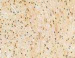 Lass2 Antibody in Immunohistochemistry (Paraffin) (IHC (P))