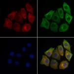 LAT Antibody in Immunocytochemistry (ICC/IF)