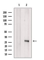 LAT Antibody in Western Blot (WB)