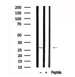 LAT Antibody in Western Blot (WB)