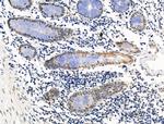 Galectin 7 Antibody in Immunohistochemistry (Paraffin) (IHC (P))