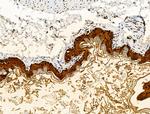 Galectin 7 Antibody in Immunohistochemistry (Paraffin) (IHC (P))