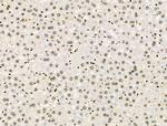 Galectin 7 Antibody in Immunohistochemistry (Paraffin) (IHC (P))