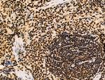 Galectin 7 Antibody in Immunohistochemistry (Paraffin) (IHC (P))