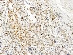 Galectin 7 Antibody in Immunohistochemistry (Paraffin) (IHC (P))