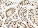 Galectin 7 Antibody in Immunohistochemistry (Paraffin) (IHC (P))