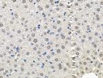 Galectin 7 Antibody in Immunohistochemistry (Paraffin) (IHC (P))