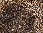 Galectin 7 Antibody in Immunohistochemistry (Paraffin) (IHC (P))