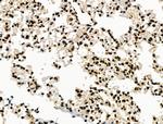 Galectin 7 Antibody in Immunohistochemistry (Paraffin) (IHC (P))