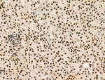 Galectin 7 Antibody in Immunohistochemistry (Paraffin) (IHC (P))