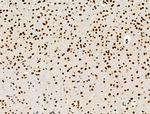 Galectin 7 Antibody in Immunohistochemistry (Paraffin) (IHC (P))