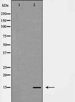 Galectin 7 Antibody in Western Blot (WB)