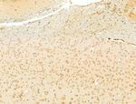 LHX6 Antibody in Immunohistochemistry (Paraffin) (IHC (P))