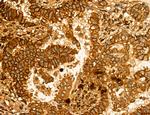 LIFR Antibody in Immunohistochemistry (Paraffin) (IHC (P))