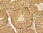 LIFR Antibody in Immunohistochemistry (Paraffin) (IHC (P))