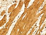 LIFR Antibody in Immunohistochemistry (Paraffin) (IHC (P))