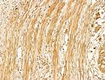 LIFR Antibody in Immunohistochemistry (Paraffin) (IHC (P))