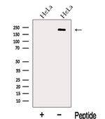 LIFR Antibody in Western Blot (WB)