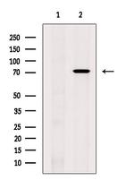 LIMK1 Antibody in Western Blot (WB)